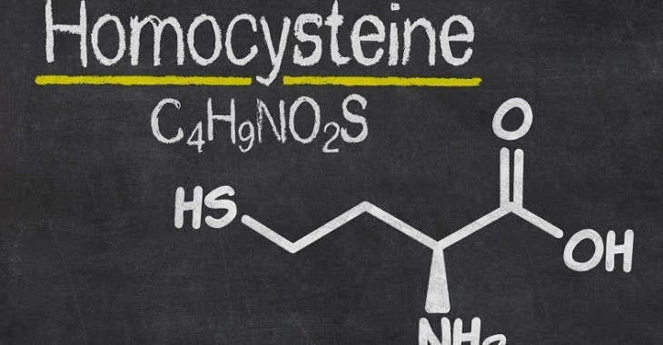 Homocysteina: co o niej wiemy? Jak ją obniżyć? Homocysteina: co o niej wiemy? Jak ją obniżyć?